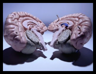split-brain